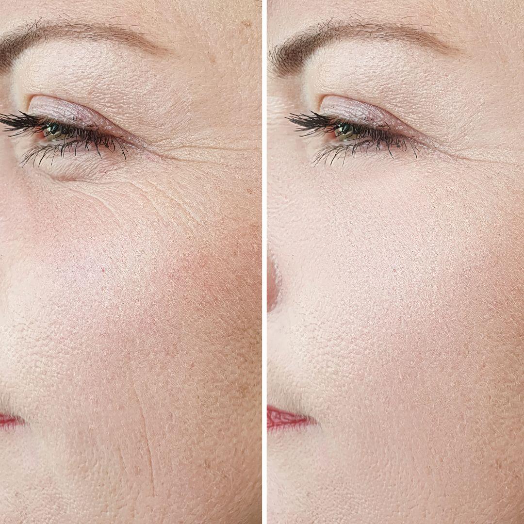 Skincare Routine To Help Fix The Look of Fine Lines and Wrinkles , Sarah Zimmer , Skincare , NAYA , nayaglow.com
