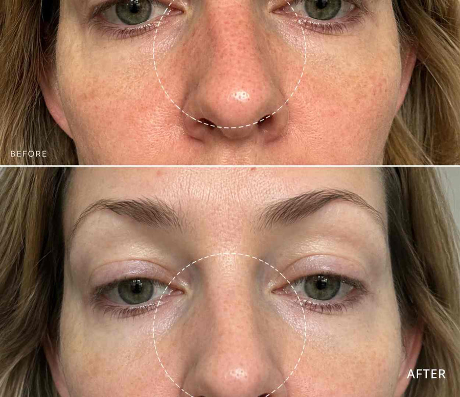 Orla, 44