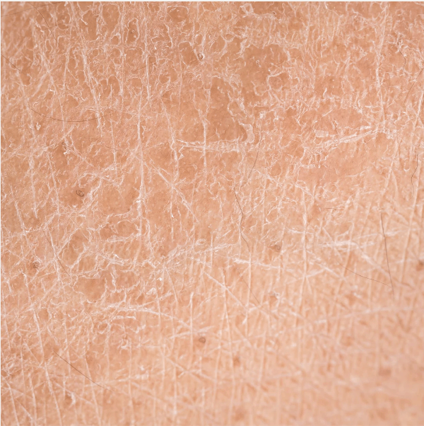 Dry vs Dehydrated Skin: How to Tell in 60 Seconds