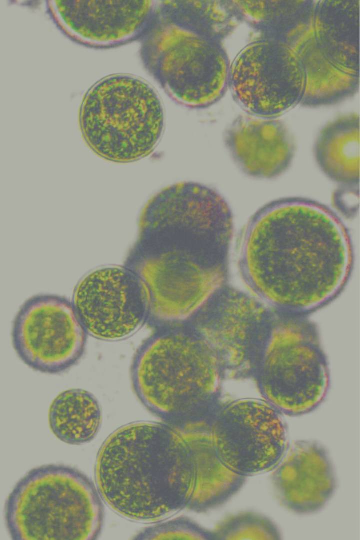 Exosomes in Skincare: How to Read an INCI List and Spot False Claims | NAYA