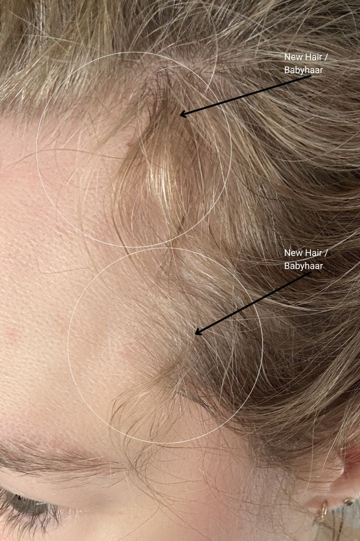 The Science of Hair Growth: Why It All Starts at the Root