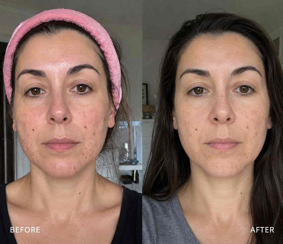 Elena, 44