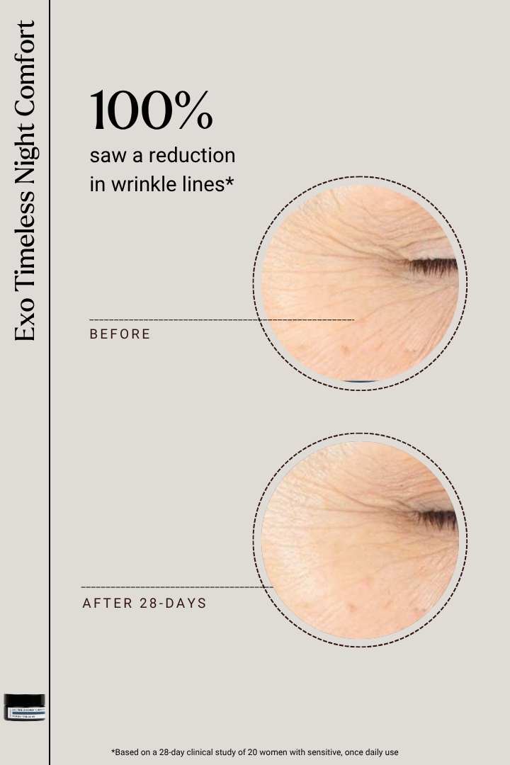 EXOSOMES | Exo Timeless Night Comfort