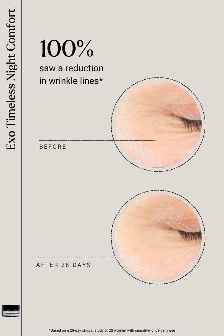 EXOSOMES | Exo Timeless Night Comfort