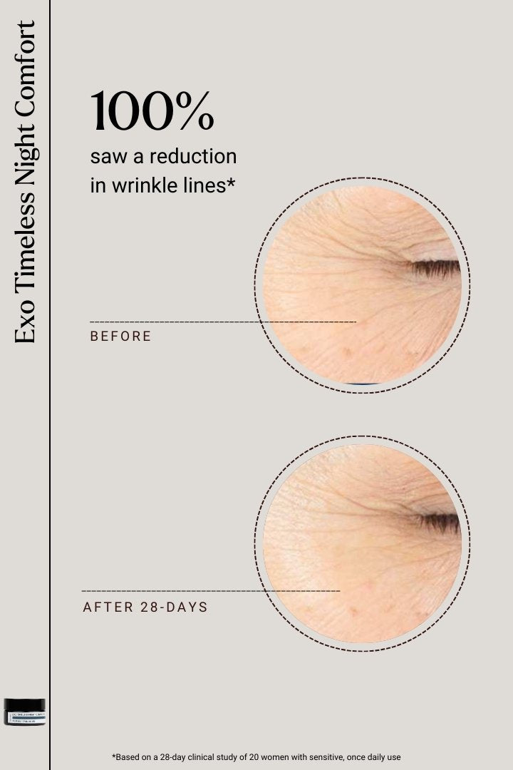 EXOSOMES | Exo Timeless Night Comfort