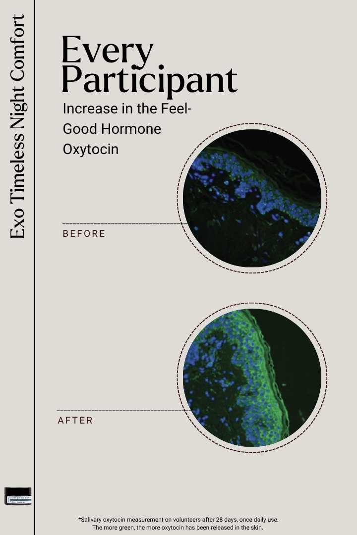 EXOSOMES | Exo Timeless Night Comfort
