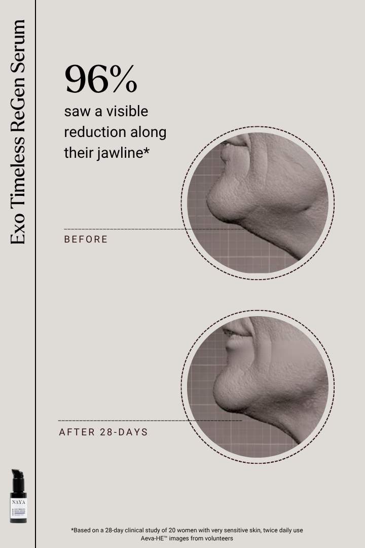 clinical results for Exo Timeless ReGen Serum showing before and after effects on a jawline.