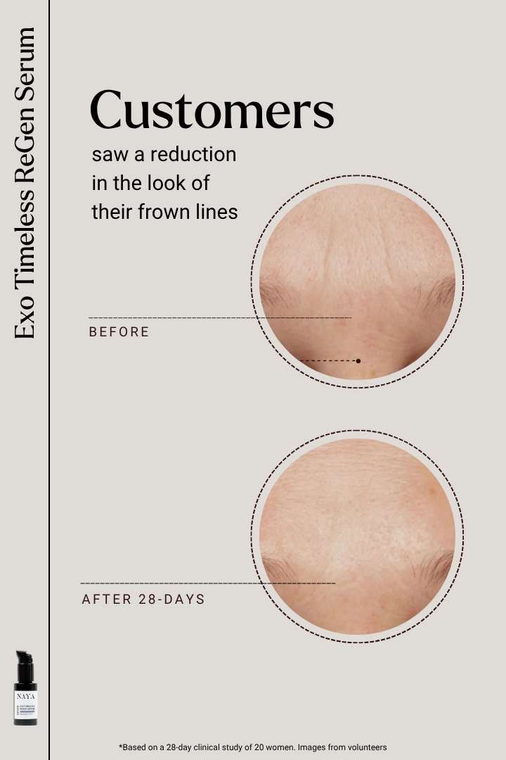 EXOSOMES | Exo Timeless ReGen Serum