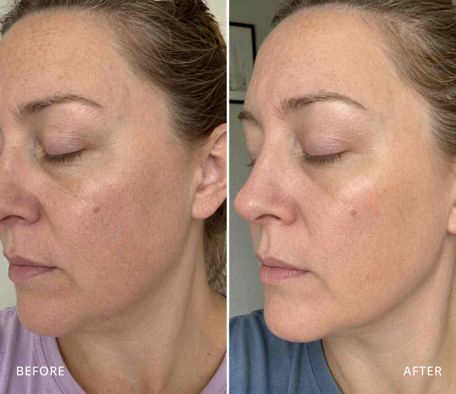Fiona, 47
