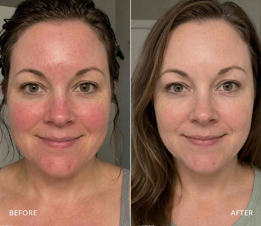 Hannah, 41