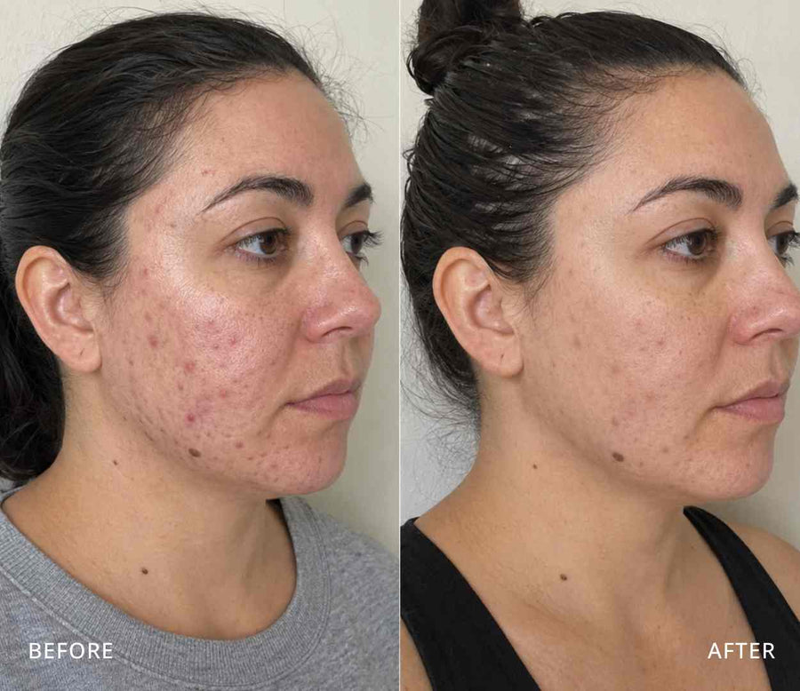 Leila, 37