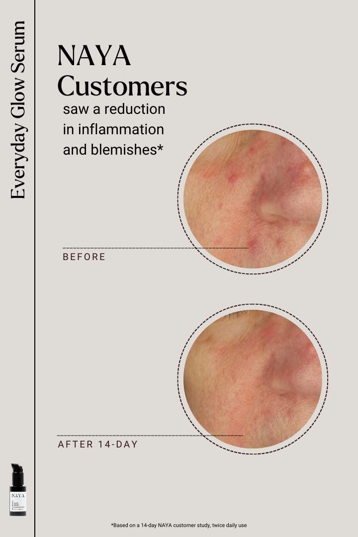 clinical results for NAYA Everyday Glow Serum showing before and after effects on skin.