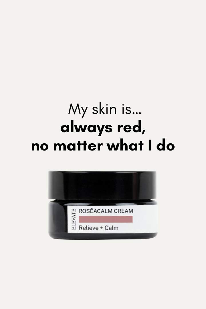 RosēaCalm Cream for Rosacea Relief | Soothe & Hydrate Skin – NAYA